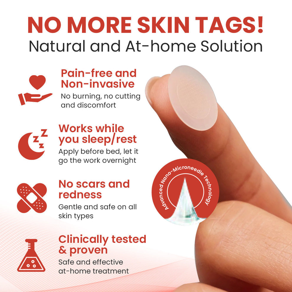 DermaSmooth Skin Tag Remover