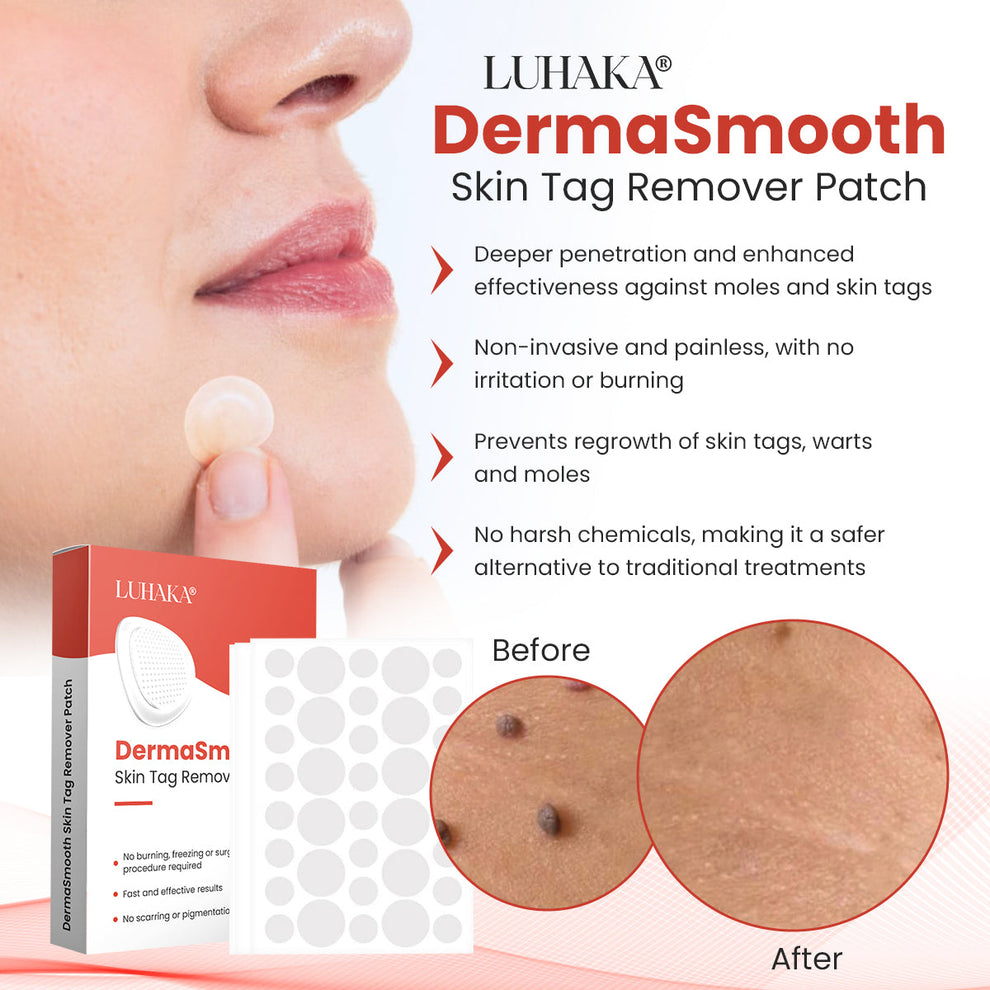 DermaSmooth Skin Tag Remover